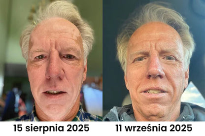 Krem na leczenie bielactwa BeeVenom