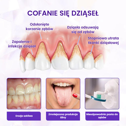 BeeRenew – Zaawansowana pasta do regeneracji dziąseł