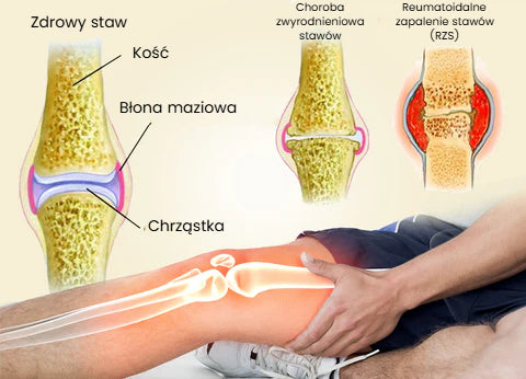 Profesjonalny żel pielęgnacyjny z jadem pszczelim z Nowej Zelandii (nowa formuła)