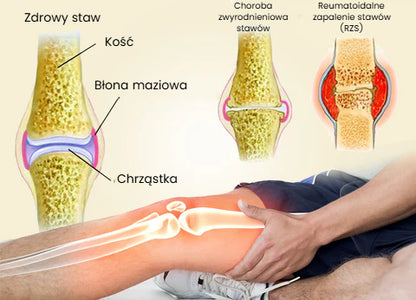 Profesjonalny żel pielęgnacyjny z jadem pszczelim z Nowej Zelandii (nowa formuła)