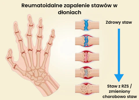 Profesjonalny żel pielęgnacyjny z jadem pszczelim z Nowej Zelandii (nowa formuła)