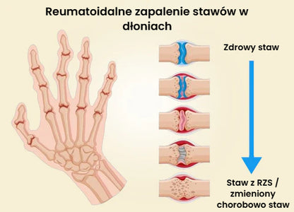Profesjonalny żel pielęgnacyjny z jadem pszczelim z Nowej Zelandii (nowa formuła)