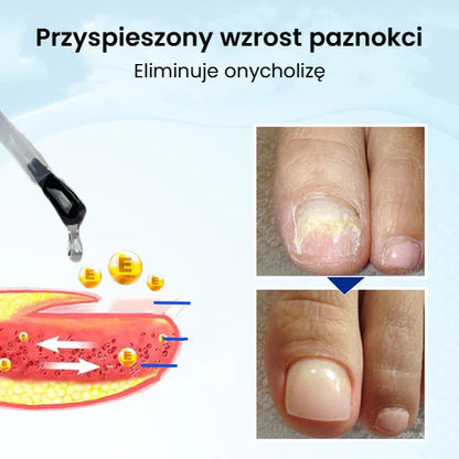 Serum na wzrost i regenerację paznokci OnyxoGuard