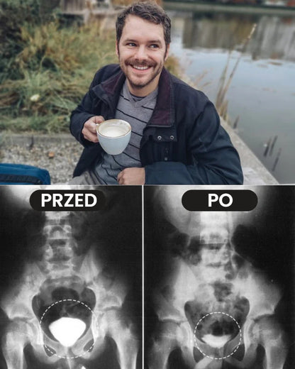 Prostavex™ – Inhalator na prostatę z jadem pszczelim | Odzyskaj erekcję w 3 minuty!