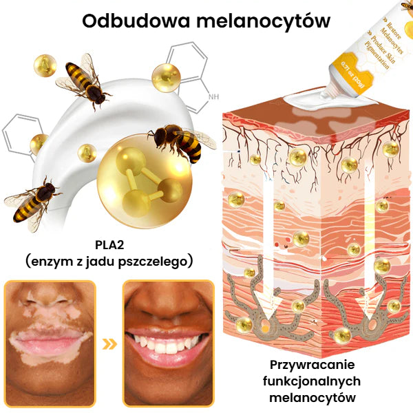 Krem na leczenie bielactwa BeeVenom