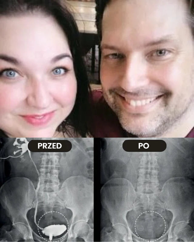 Prostavex™ – Inhalator na prostatę z jadem pszczelim | Odzyskaj erekcję w 3 minuty!