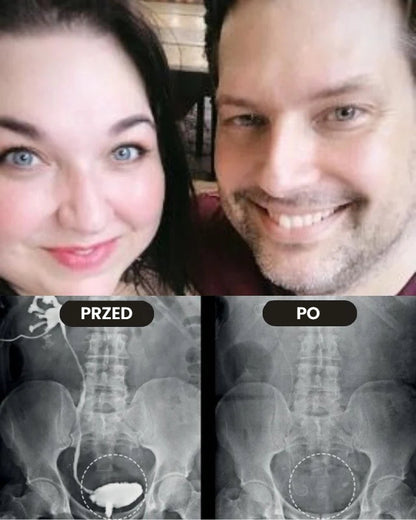 Prostavex™ – Inhalator na prostatę z jadem pszczelim | Odzyskaj erekcję w 3 minuty!