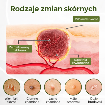 Krem odnawiający Biancat® KeraErase Dual-Action