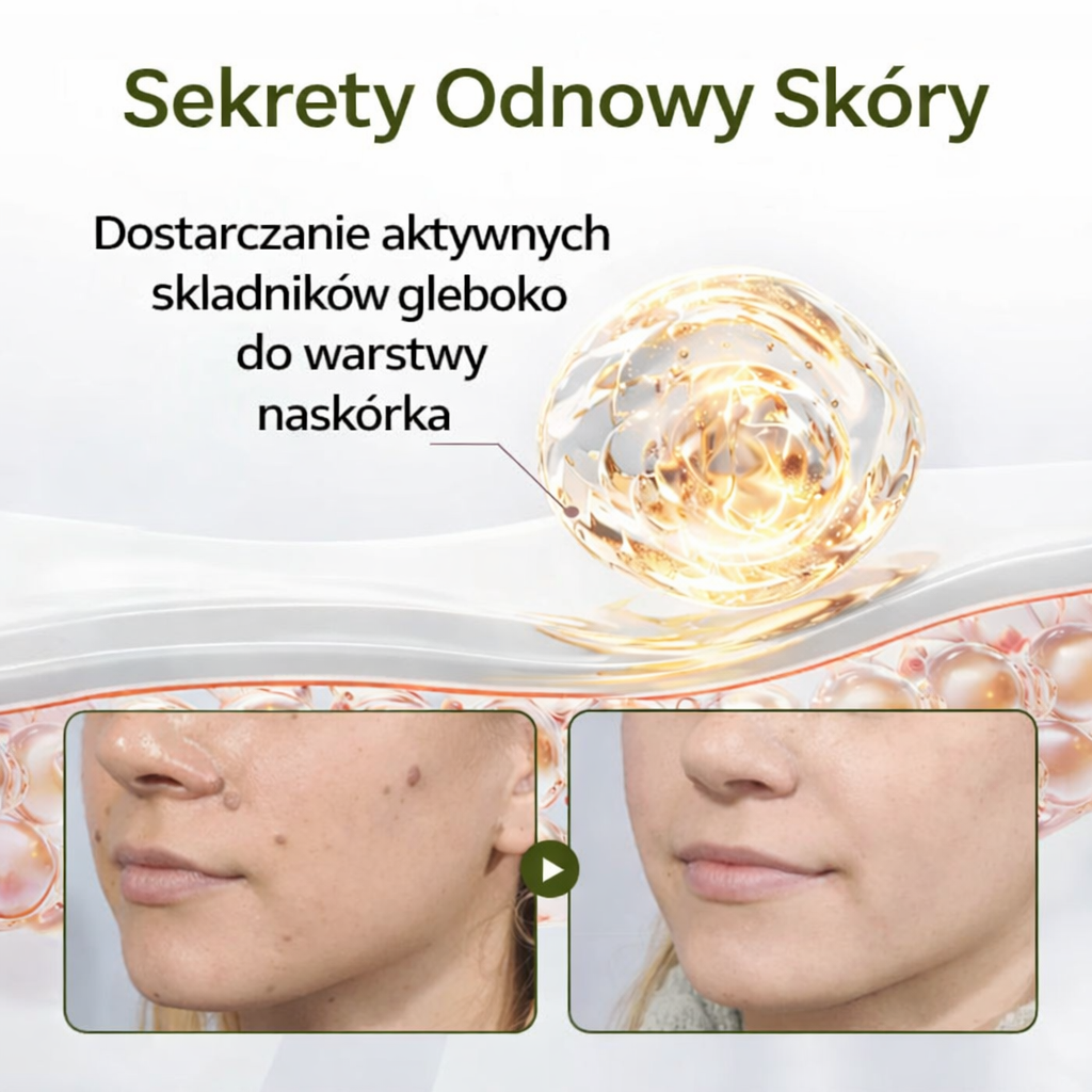 Krem odnawiający Biancat® KeraErase Dual-Action