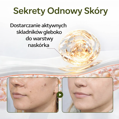 Krem odnawiający Biancat® KeraErase Dual-Action